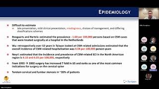 Cervical Spondylotic Myelopathy presented by Michael Pompliano MD on April 1 2024 [upl. by Aidile706]