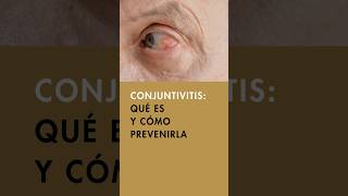 👀 Todo sobre la Conjuntivitis síntomas causas y tratamientos efectivos  Ojo rojo y cuidado ocular [upl. by Afira]