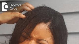 Reasons for itchy scalp and how to treat it  Dr Rasya Dixit [upl. by Lem726]