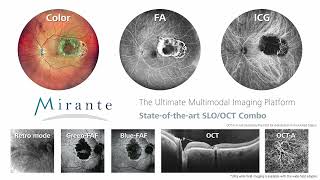 NIDEK  Introducing the US Edition Mirante SLO and SLOOCT [upl. by Yila]