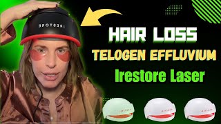 quotThe Ultimate Solution for Hair Regrowth iRestore Elite Laser System Reviewquot [upl. by Maillil]