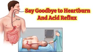 Reduce your Acid Reflux  Heartburn  Health is Wealth 458 [upl. by Selrhc]