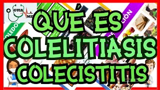 QUÉ ES COLELITIASIS Y COLECISTITIS  GuiaMed [upl. by Yren]