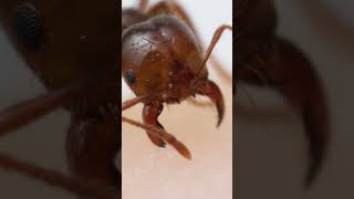 Fire ant bite and sting upclose [upl. by Schoenberg]