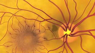 Pupillary light reflex pathway  Part 1 Including Sample Questions [upl. by Gasperoni]