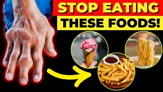 10 Most Dangerous Foods For Arthritis That You Often Overlook [upl. by Ahsinaj]