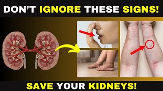 Top Warning Signs Your Kidneys Are Dying [upl. by Yee]