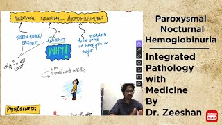 Paroxysmal Nocturnal Hemoglobinuria PNH in HindiHinglish pathology medicine neetpg inicet [upl. by Madora]