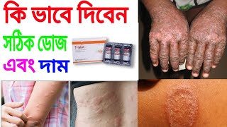 trialon ইনজেকশন এর কাজ কি full review Bangla [upl. by Xenia846]