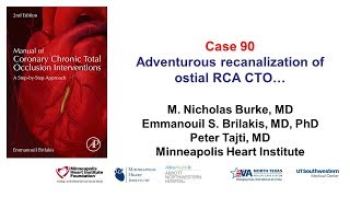 Case 90 Manual of CTO Interentions Adventurous ostial RCA CTO recanalization [upl. by Younger38]