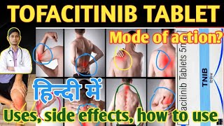 Tofacitinib 5 mg tablet uses side effects how to use in hindi tofacitinib [upl. by Erdrich714]