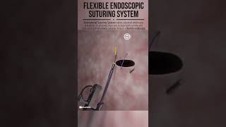 Flexible Endoscopic Endolumenal Suturing System shorts tech suturing endoscopy animation [upl. by Blood424]