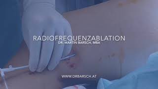 Radiofrequenz der Stammvene Vena Saphena Magna Minimalinvasive Venen Operation Varizen [upl. by Furie415]