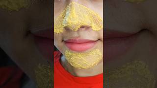 easy way to remove blackhead and Whitehead at home remedy shorts youtubeshorts treandinghacks [upl. by Dwayne]