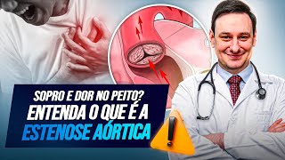 SOPRO NO CORAÇÃO Entenda a ESTENOSE AORTICA [upl. by Ayortal312]