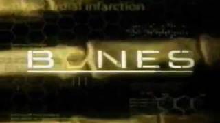 Bones  1x01  Pilot Promo [upl. by Nnahoj]