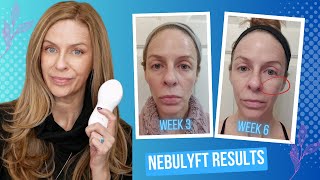 Skin Tightening Results  What I Learned Using Nebulyft R2 3X Per Week vs Daily Use [upl. by O'Donovan]