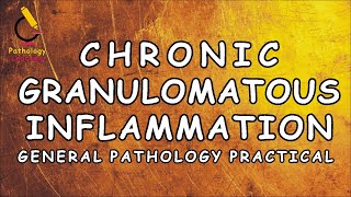 Chronic Granulomatous Inflammation  General Pathology Practical  Pathology Learning [upl. by Ybrek]