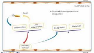 Sepsis development and progression [upl. by Leryt]