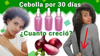 JUGO DE CEBOLLA para el CRECIMIENTO DEL CABELLO😱 ANTES Y DESPUÉS Funciona🤔 [upl. by Stets]