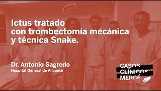 Caso Clínico Mercé 62 Ictus tratado con trombectomía mecánica y técnica Snake HGeneral Alicante [upl. by Erodoeht]