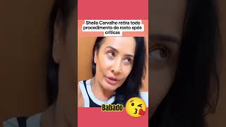 Sheila Carvalho tira todo o procedimento do rosto e fica mais linda shorts noticias video top [upl. by Muhan237]