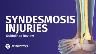 Ankle Syndesmosis Injury Guideline  SYNOPSIS [upl. by Akemhs498]