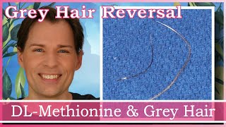 GREY HAIR REVERSAL CATALASE HELP AND DLMETHIONINE  HYDROGEN PEROXIDE  ANTIOXIDANTS  STOP GREYS [upl. by Artenahs]