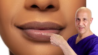 How to Plump Your Lips Naturally Dr Mandell [upl. by Zurkow]