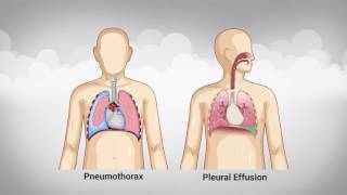 MedSim  Respiratory System [upl. by Elman]