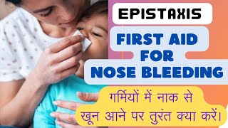 नाक से खून आने पर तुरंत क्या करें।NOSE bleeding causesfirst aid and treatment [upl. by Halet200]