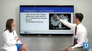 Causes of High Calcium  Masha Livhits MD amp Michael Yeh MD  UCLAMDChat [upl. by Germain789]