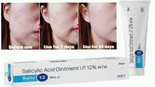 Salic 12 Ointment Cream Salicylic Acid Ointment IP 12 ww [upl. by Fredra]