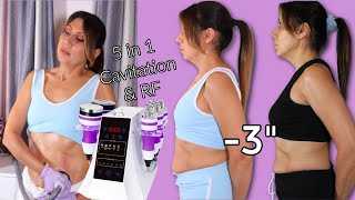 HONEST REVIEW At home Claire 5 In 1 Cavitation Machine  Before And After Results  Surebeauty [upl. by Treulich]