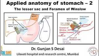 Lesser sac and foramen of Winslow  Applied anatomy of stomach part 2 [upl. by Aikemahs]