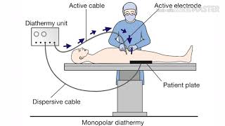 How diathermy works [upl. by Alaham]