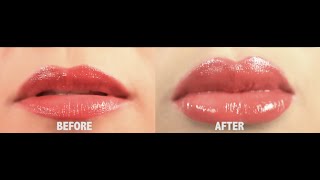 How To Get BIG LUSCIOUS LIPS without lip collagen injections [upl. by Macdougall]