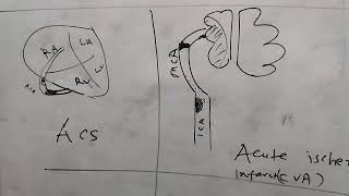 antiplatelet and anticoagulant in myocardial infarction [upl. by Sihtam]