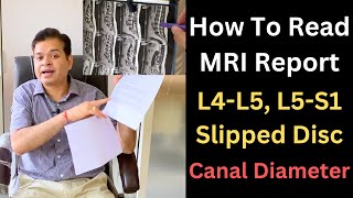 Lower Back MRI L4 L5 Herniated Disc MRI Stenosis of the Spine How to know Lumbar canal Diameter [upl. by Rehotsirk]