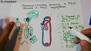 CVS physiology 235  Abnormal circulatory dynamics in Mitral stenosis and Mitral regurgitation [upl. by Htebsil]