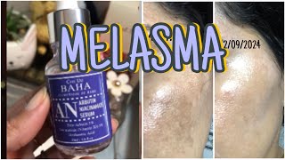 MELASMA SERUM COREANO COSDEBAHA melasma kbeauty cosdebaha [upl. by Haldan]