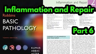 Arachidonic Acid metabolites Robbins pathologyProstaglandins and LeukotrienesInflammatory Mediator [upl. by Lladnyk567]