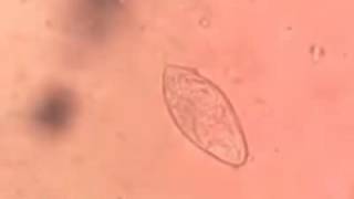 Schistosoma haematobium egg [upl. by Nirda488]