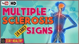 16 Multiple Sclerosis Symptoms Early Warning Signs [upl. by Alaster]