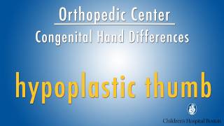 hypoplastic thumb  congenital hand differences  Boston Childrens Hospital [upl. by Randal]