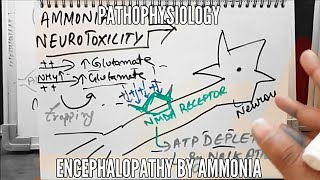 Ammonia Neurotoxicity  Encephalopathy  Pathophysiology [upl. by Anitreb]