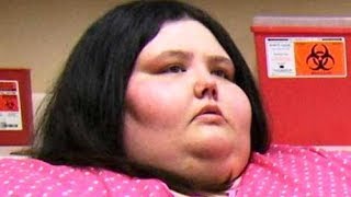 The Most Dramatic Transformations Ever Seen On My 600lb Life [upl. by Adanar]