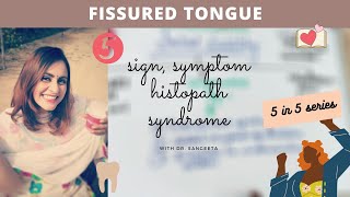 fissured tongue I oral pathology lectures [upl. by Martel]