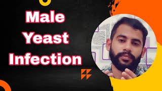 Male yeast infectionMalayalamCauses amp Treatment [upl. by Inuat31]