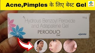 Peroduo Gel Use in Hindi  Benzoyl peroxide amp Adapalene Gel Use  Acne  pimples  SK MEDICINE [upl. by Pritchard]